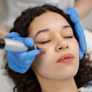PRP Facial